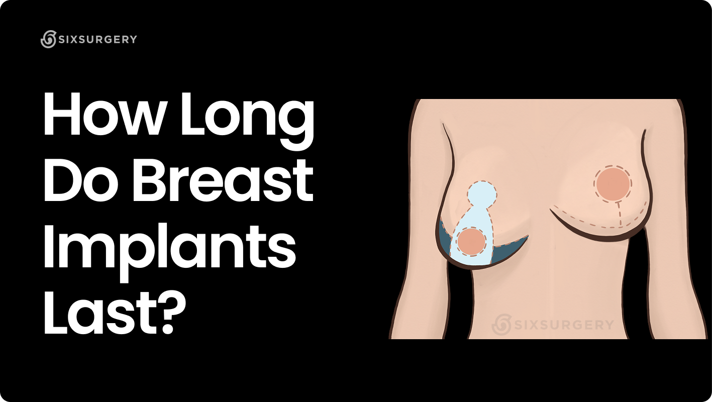 How Long do Breast Implants Last