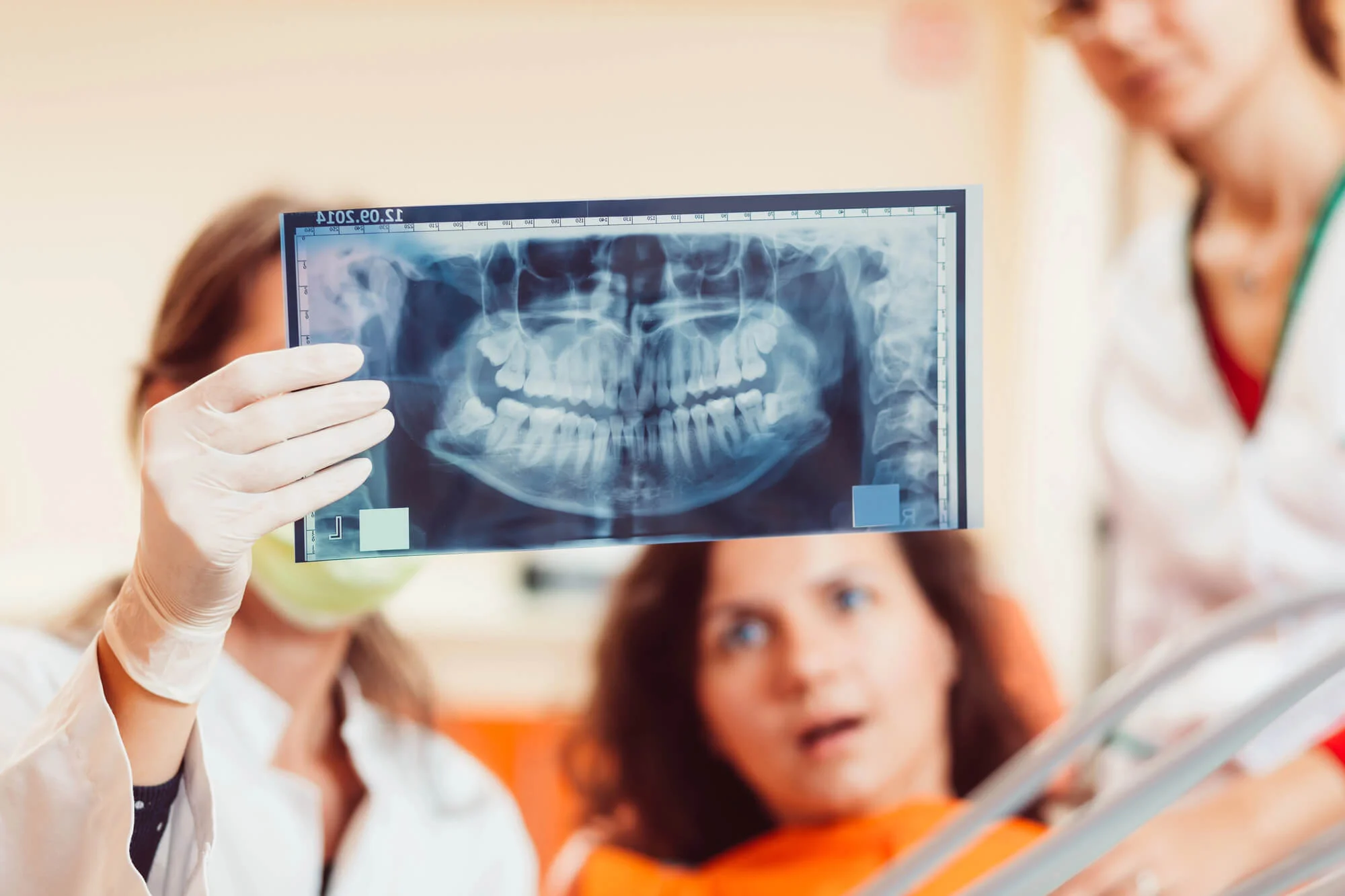 dentist showing an X-ray image of her Wisdom teeth needing Oral Surgery in Houston