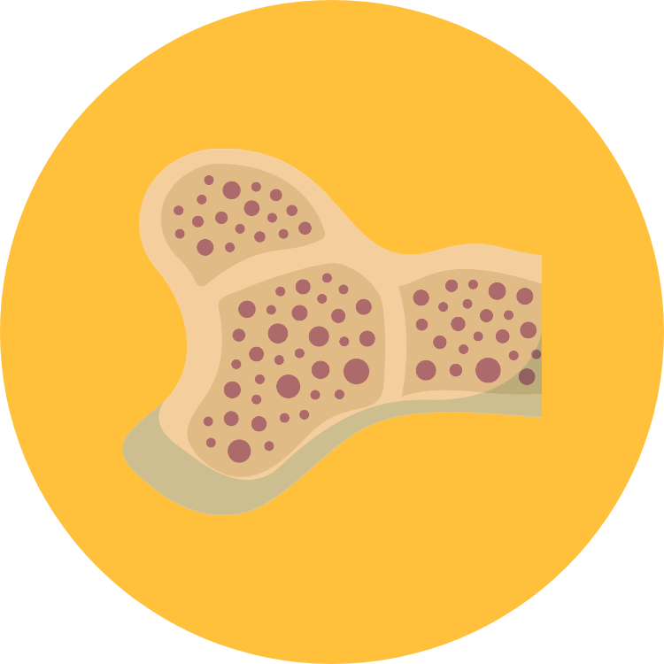 bone cancer