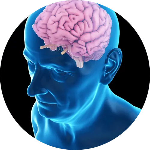 troubles cerebro-vasculaires