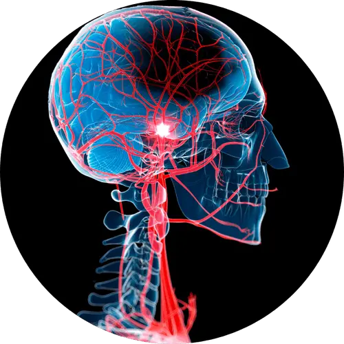 troubles neuro-inflammatoires