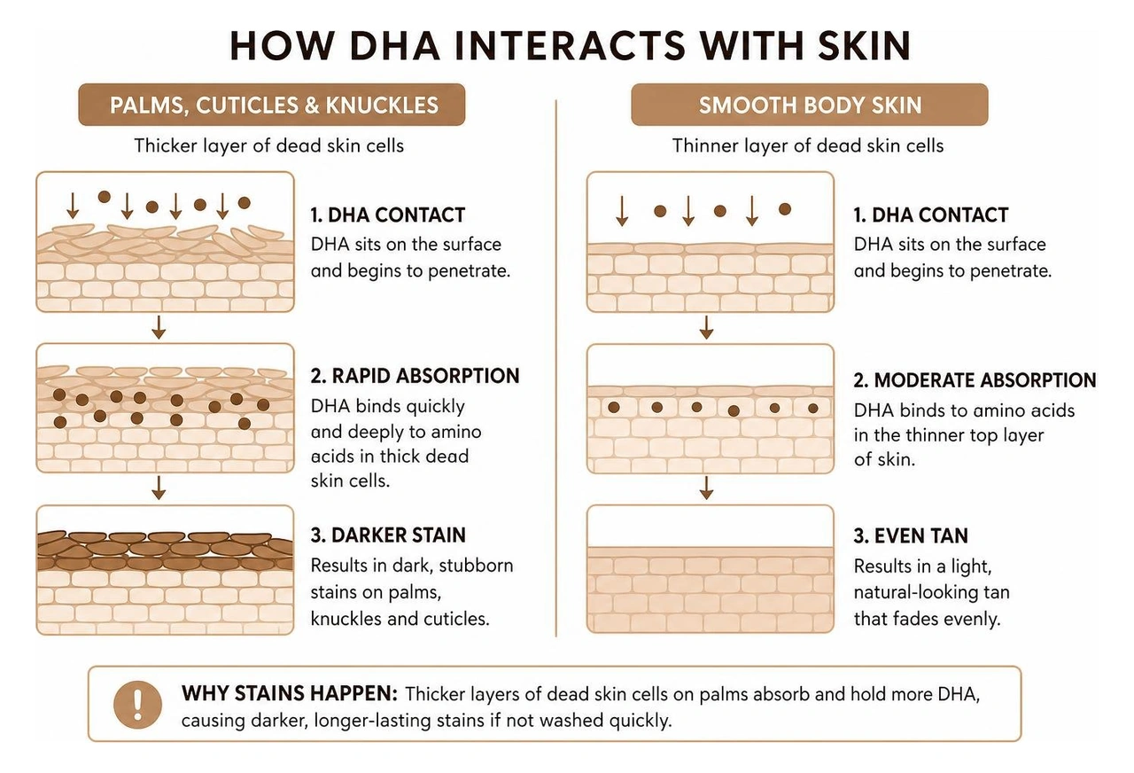 Diagram showing how DHA interacts with dead skin cells on palms vs smooth body skin Diagram showing how DHA interacts with dead skin cells on palms vs smooth body skin