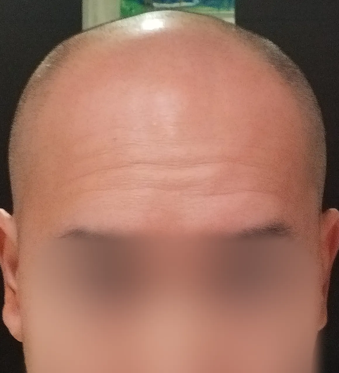 M.R