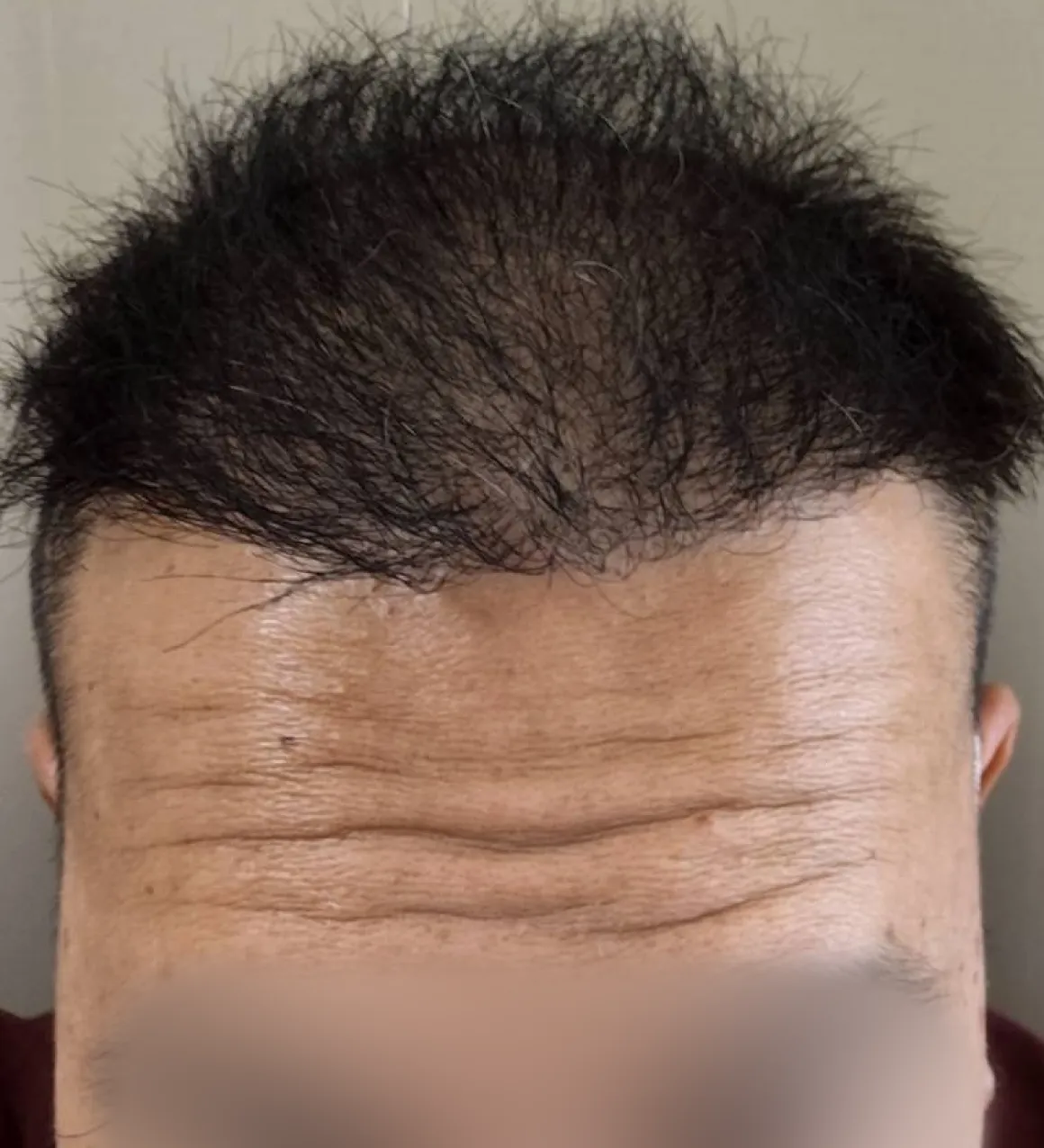 M.R