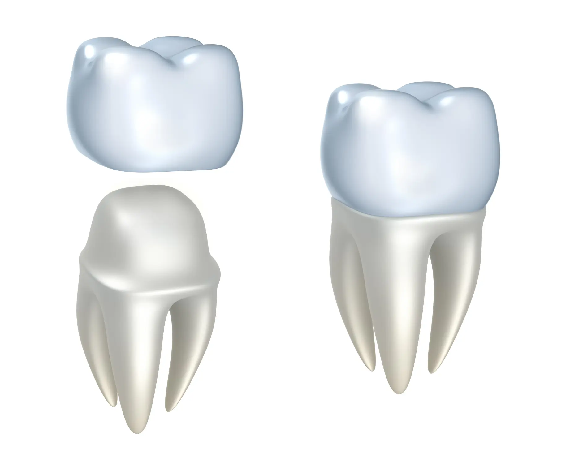 How to Handle a Knocked-Out Tooth or a Cracked Dental Crown: A Dentist’s Guide