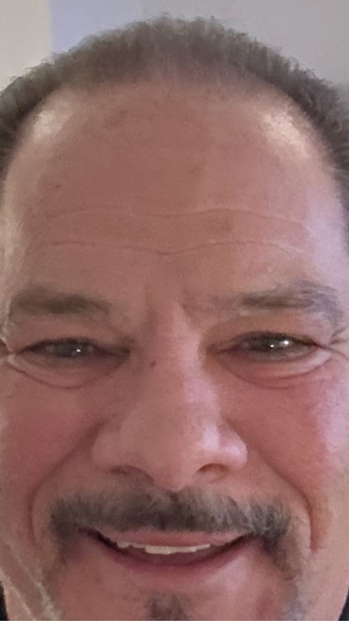 Larry, Locklab patient