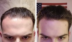 Cody before and after