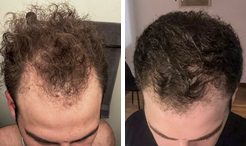 Juda before and after