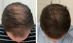 David before and after
