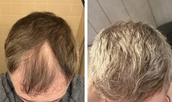 Kyle before and after