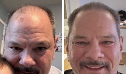 Larry before and after