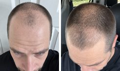 Seth before and after