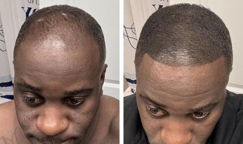 Armando before and after