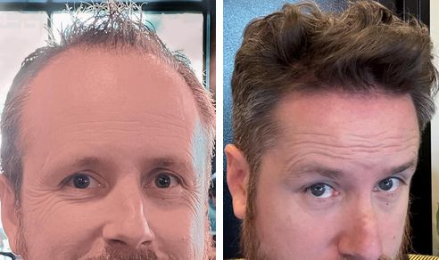 Jason before and after