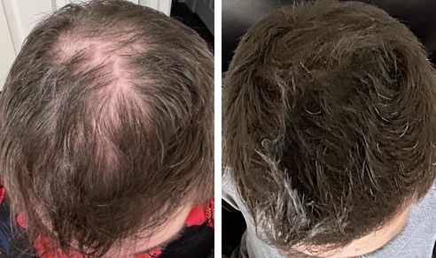Sam before and after