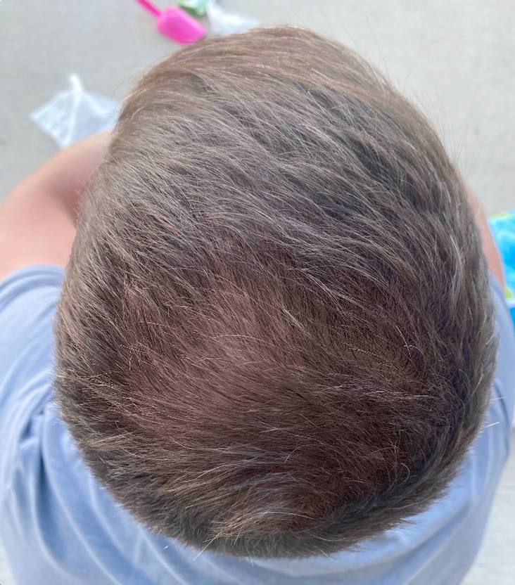 Crown after Locklab treatment