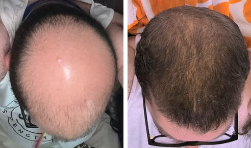 Dill before and after