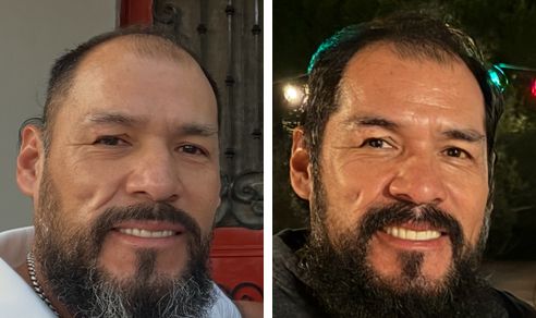 Arturo before and after