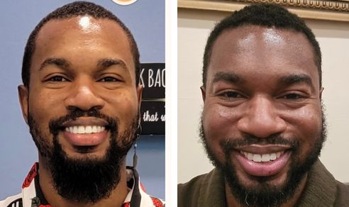 Corey before and after