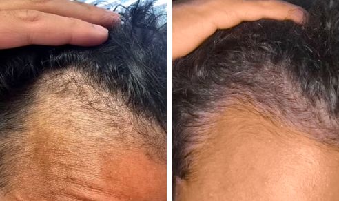 Edwin before and after