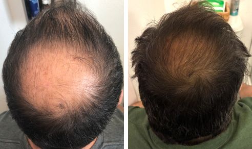 Eric before and after