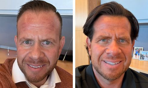Howard before and after