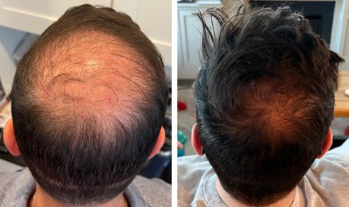 John before and after