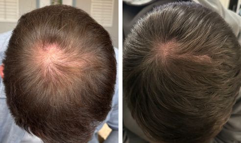 Michael before and after