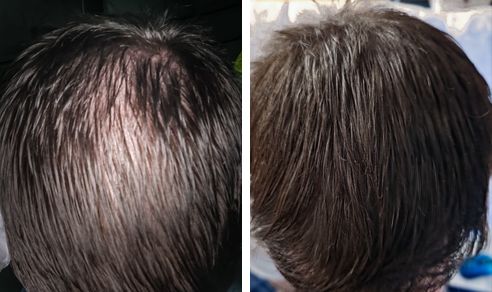 Kenneth before and after