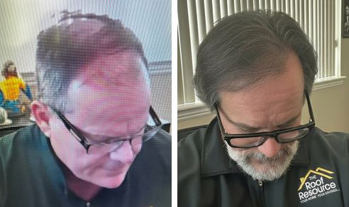 Mike before and after