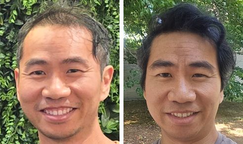 Philip before and after