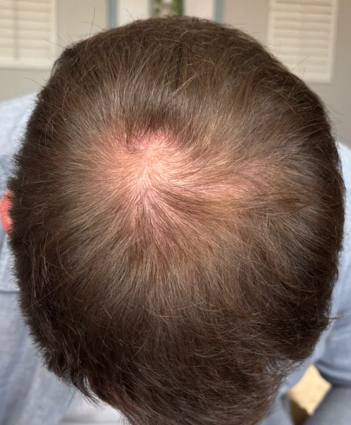 Michael before