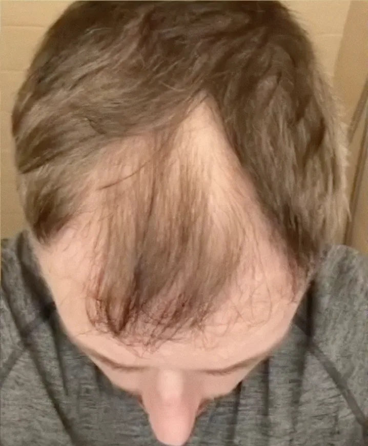 Kyle before