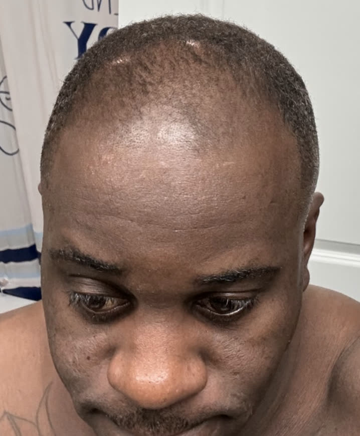 Armando before