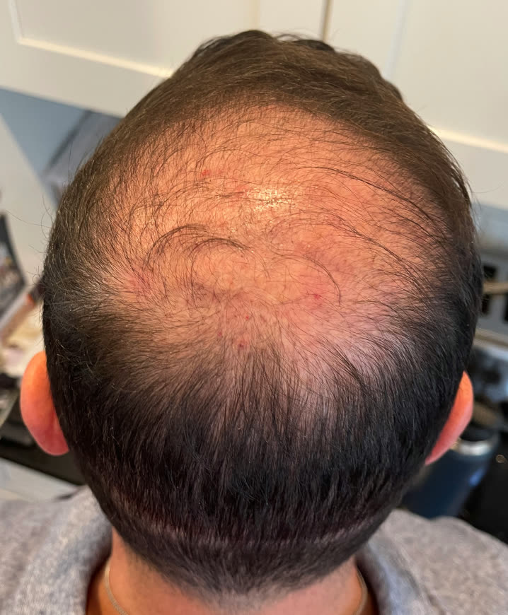 John before