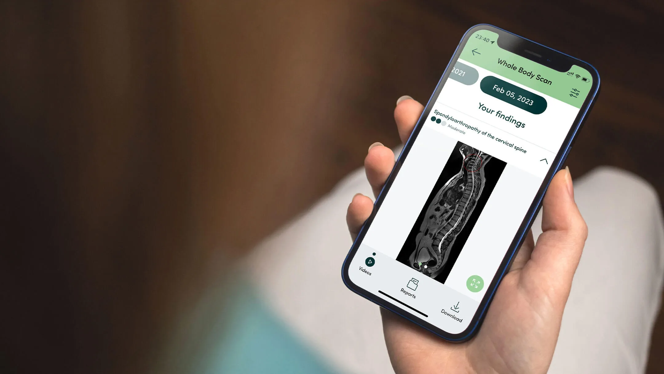 A hand holding a phone showing a spine scan in the Prenuvo app