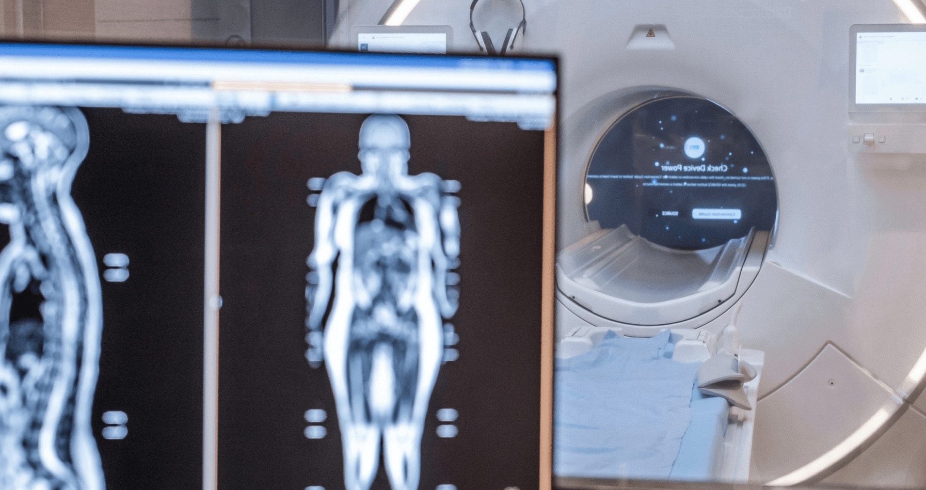 A Prenuvo MRI scanner beside a monitor showing whole body scan images