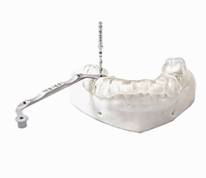 Dental Implant Guide