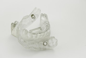 dental implant surgical guide