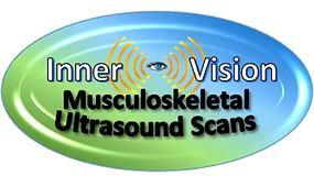 Inner-Vision Musculoskeletal Ultrasound Scans