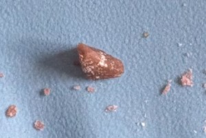 Dangerous drug alert issued for Saskatoon