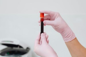 Opinion: Tuberculosis is still the world’s deadliest infectious disease