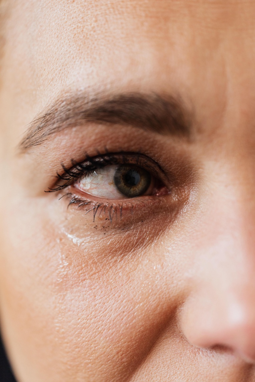 Close-up of a woman with a watery, irritated eye