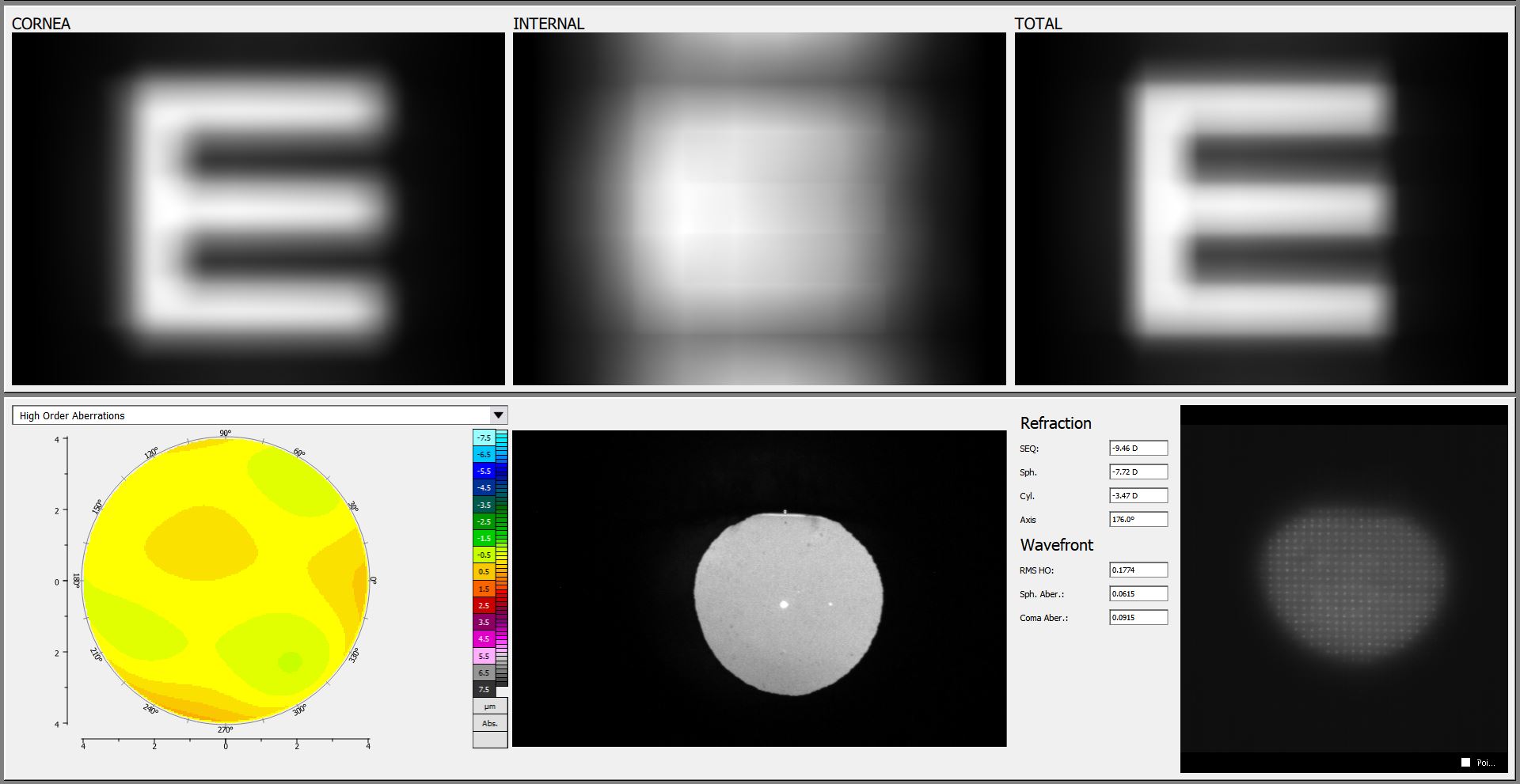 Wavefront aberrometry scan used in keratoconus diagnosis at Innovative Eye Care Adelaide