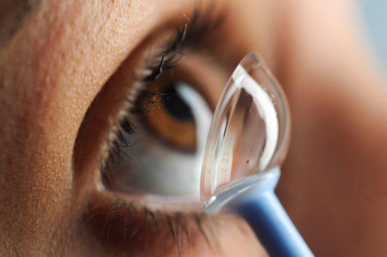 Scleral contact lens being placed onto the eye with an insertion tool