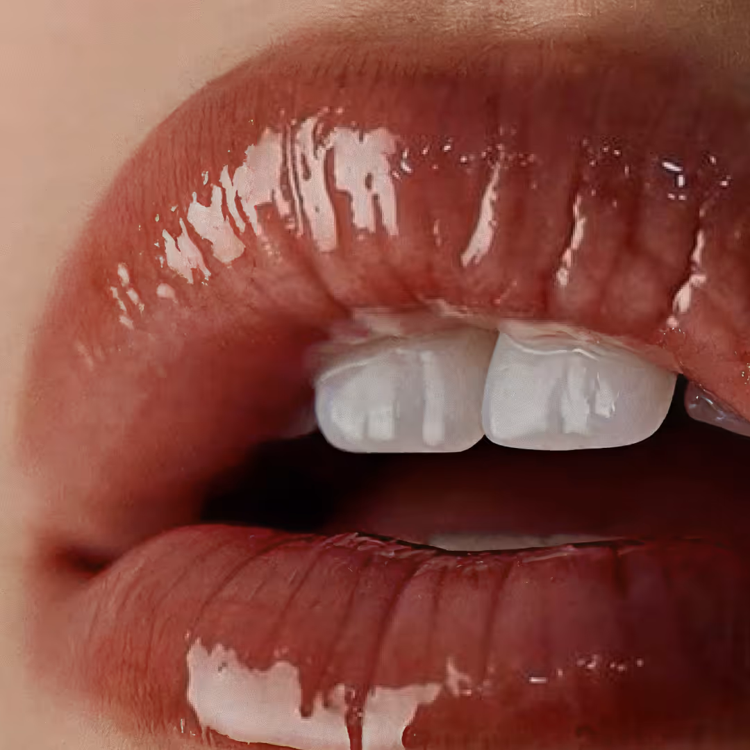 laser lip rejuvenation, lip plumping