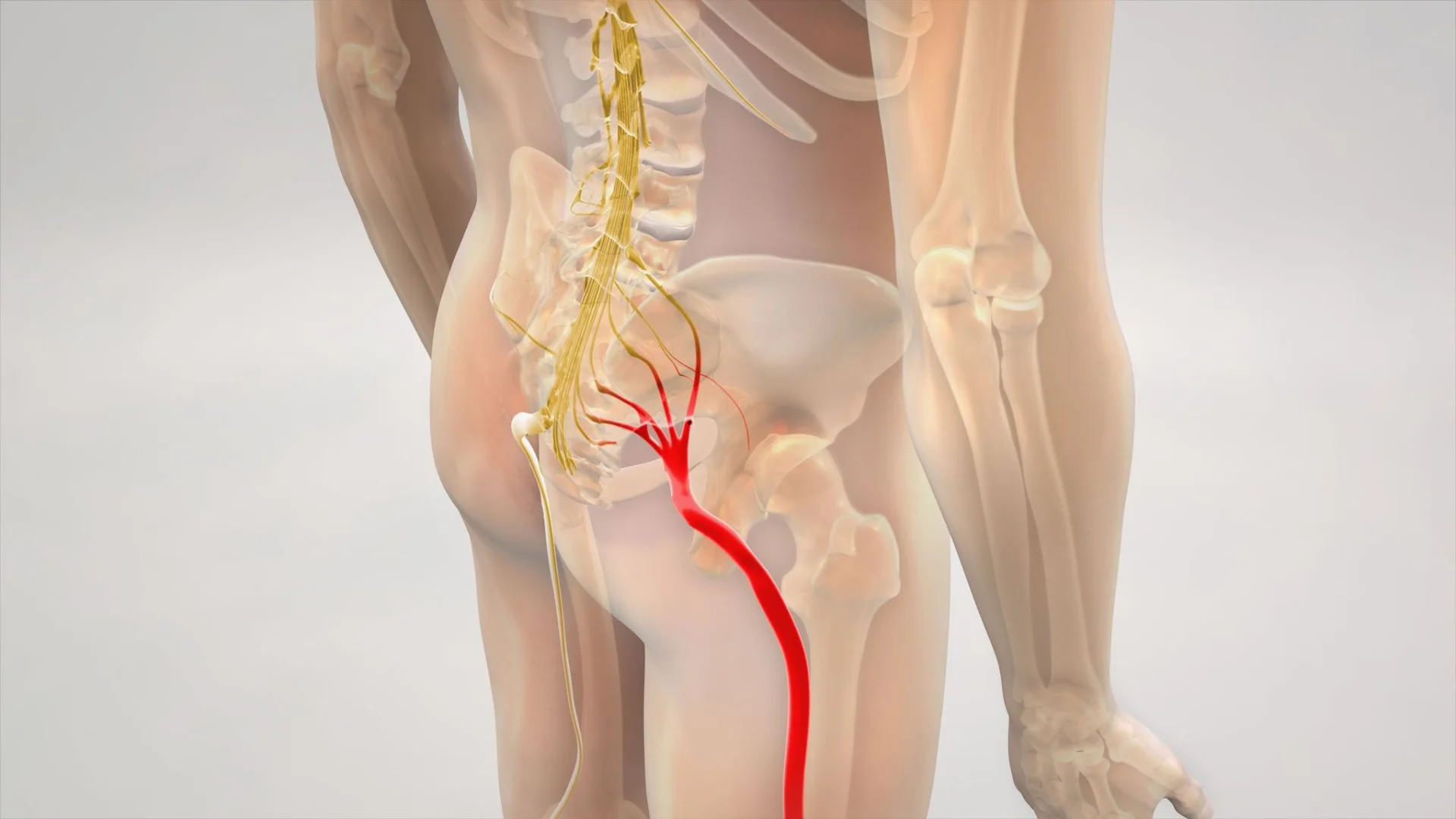 Illustration of the sciatic nerve pathway from the lumbar spine through the hips and down the leg