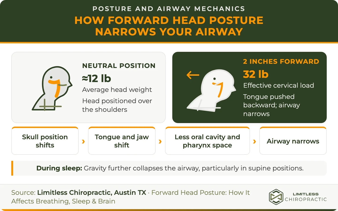 Side-by-side posture and airway mechanism infographic showing an approximately 12-pound head in neutral position versus two inches of forward head posture creating 32 pounds of effective cervical load, backward tongue displacement, reduced oral and pharyngeal space, and a narrowed airway that gravity further collapses during sleep.