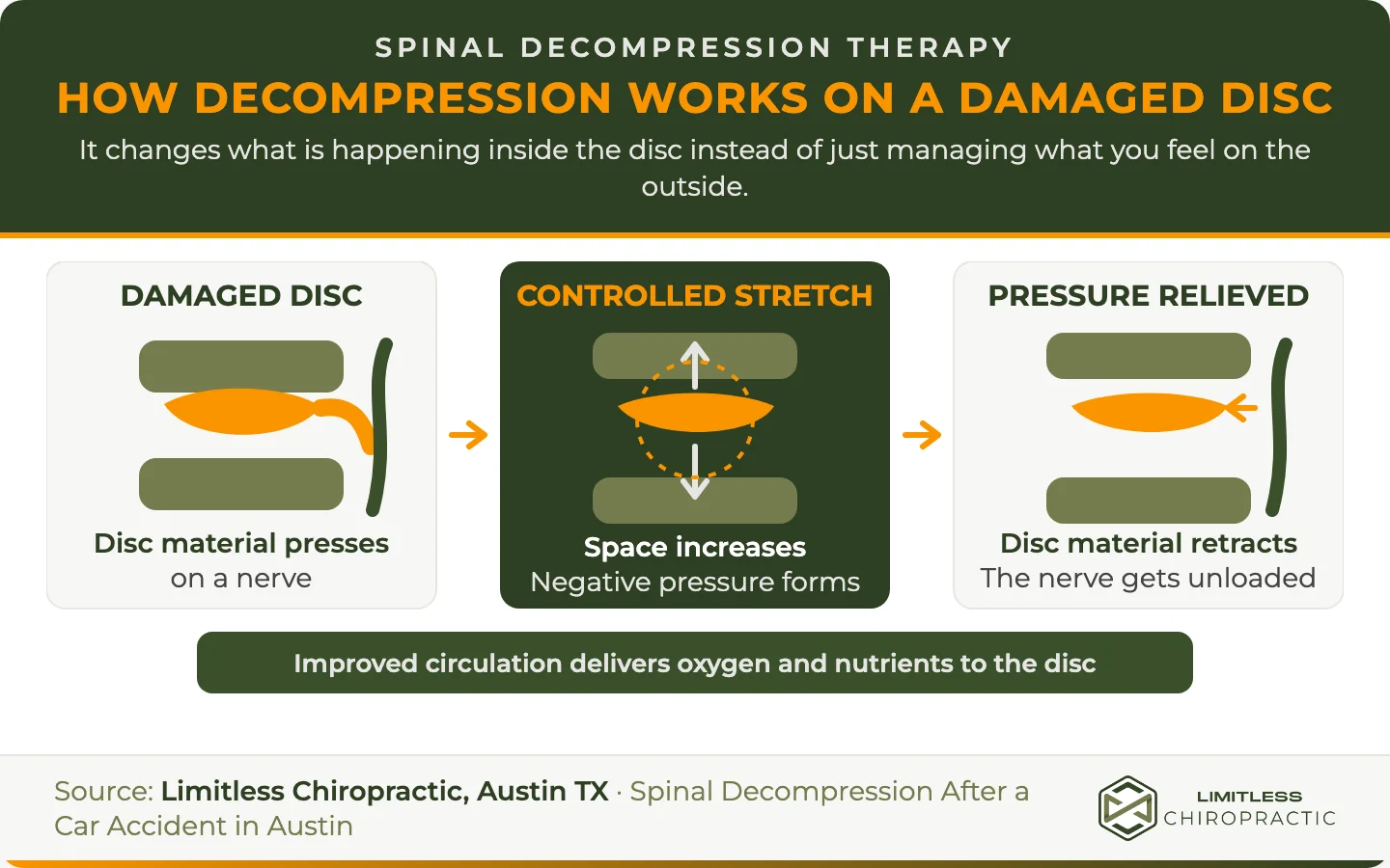 Three-stage disc diagram showing controlled spinal stretching increasing vertebral space, creating negative pressure, retracting disc material, unloading the nerve, and improving nutrient flow.