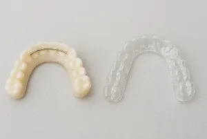An image showing fixed retainers on one side and removable retainers on the other.